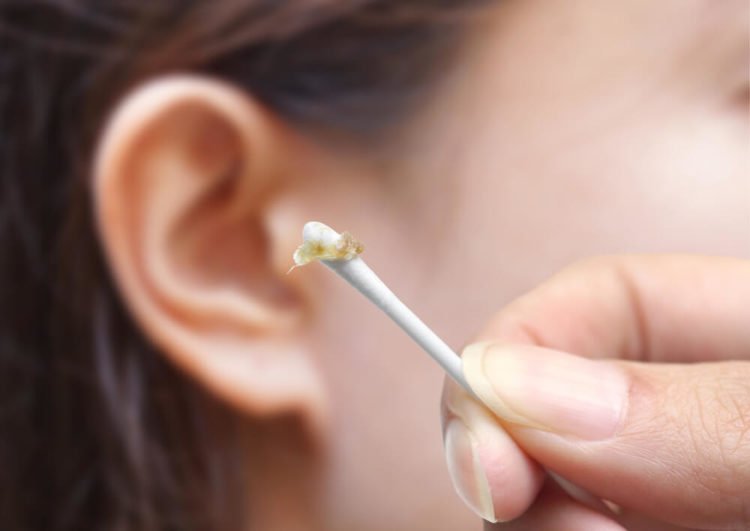 ent ear wax removal